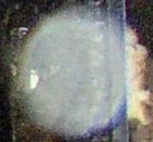 Dad's Orb Detail